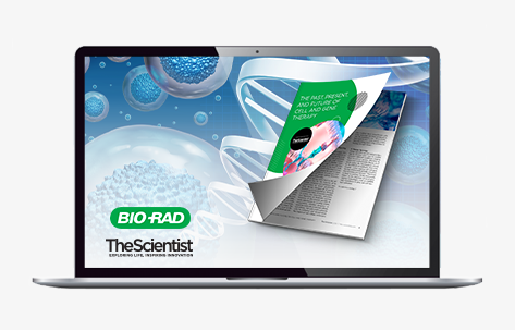 41692_TS_BioRad-Gene-Therapy_CTA-Banner_JP473x300-Laptop