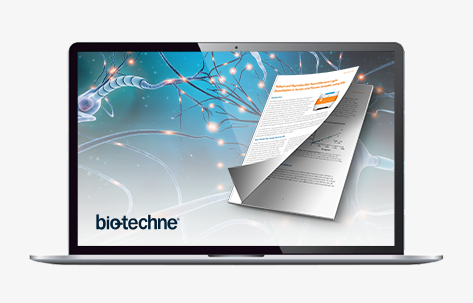 40803_TS_Bio-Techne-ProteinSimple_CTA-Banner_JP473x300-Laptop