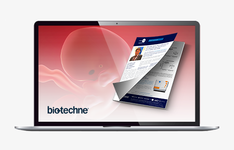 42342_TS_BioTechne-Protein-Expression_CTA-Banner_JP473x300-Laptop
