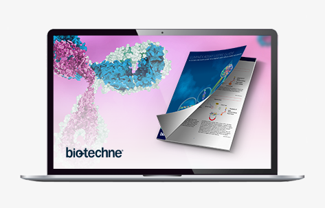 38336_TS_Bio-Techne-Immunoassay_CTA-Banner_JP473x300-Laptop