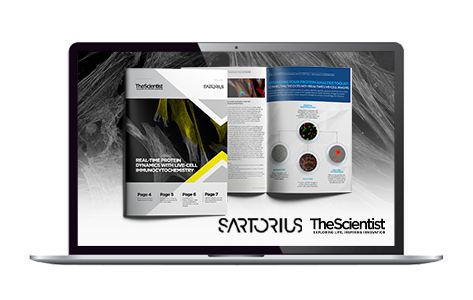 TS_Real Time Protein - Sartorius - 473x300